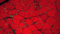 Cross section of muscle fibers seen under microscope